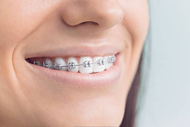 Best Teeth Whitening  in Sumas, WA